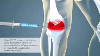 TLC599 Intra-articular Injection for Osteoarthritis Pain