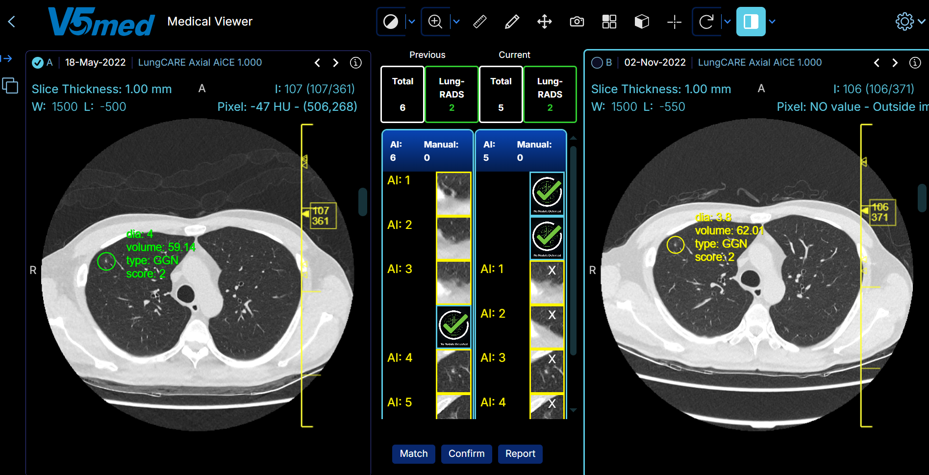 photo of Compare function1